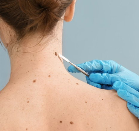 Medical Integrity, Not Just Taking a Sample