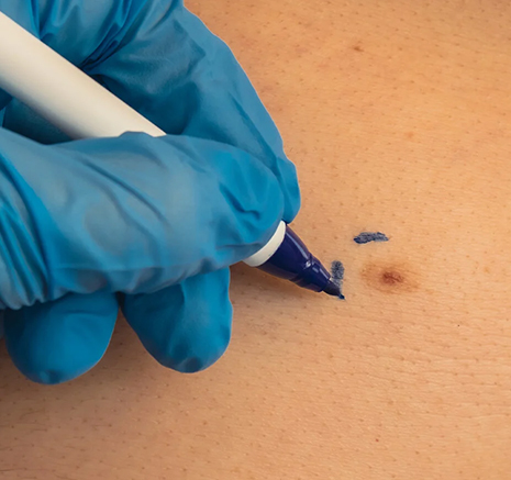 The Fifteen-Minute Clinical Procedure