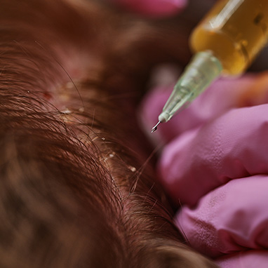 The Scalp