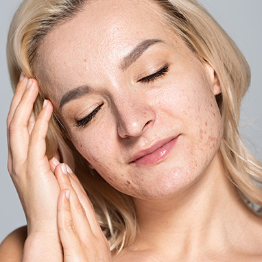 Tired Skin Quality