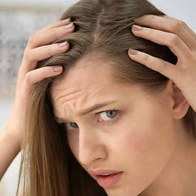 Thinning Hairlines