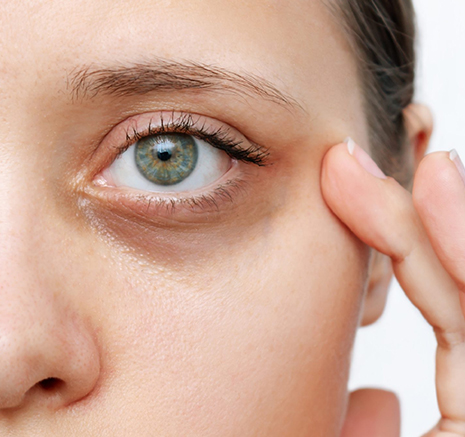 The Precision Eye-Reset