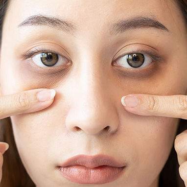 Pigmentation