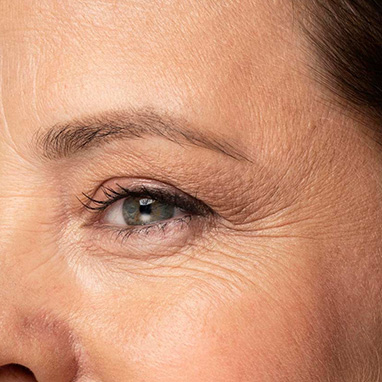 Fine Lines