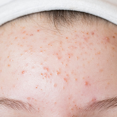 Large Pores