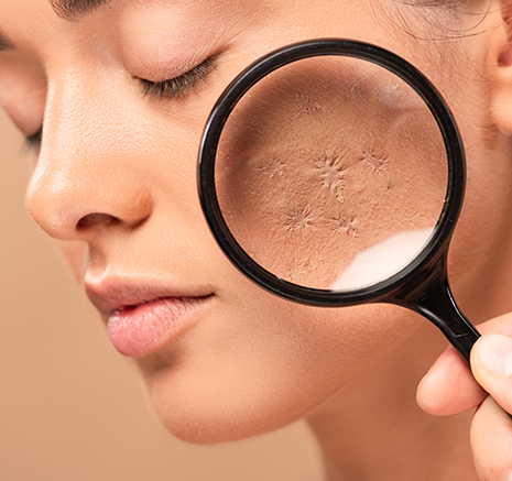 The "Desert Drought" Beneath Your Skin