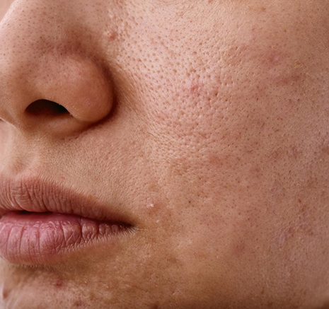 The Skin That Simply Stopped Listening