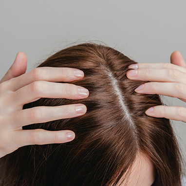 The Scalp